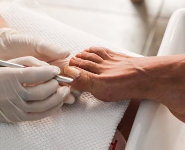 Onycholiza po stylizacji: 7 najczęstszych przyczyn i prosty plan ratunkowy dla Twoich paznokci