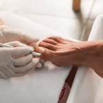 Onycholiza po stylizacji: 7 najczęstszych przyczyn i prosty plan ratunkowy dla Twoich paznokci