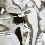 Ucz się mądrzej, nie dłużej: neuroplastyczność mózgu w praktyce codziennej nauki